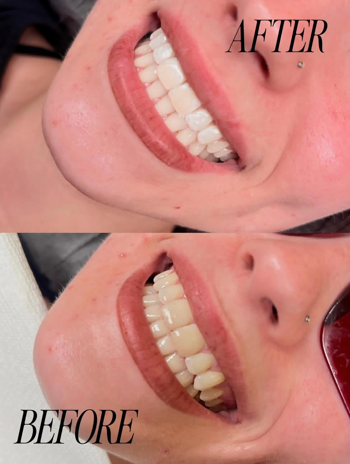 Online Teeth Whitening Course