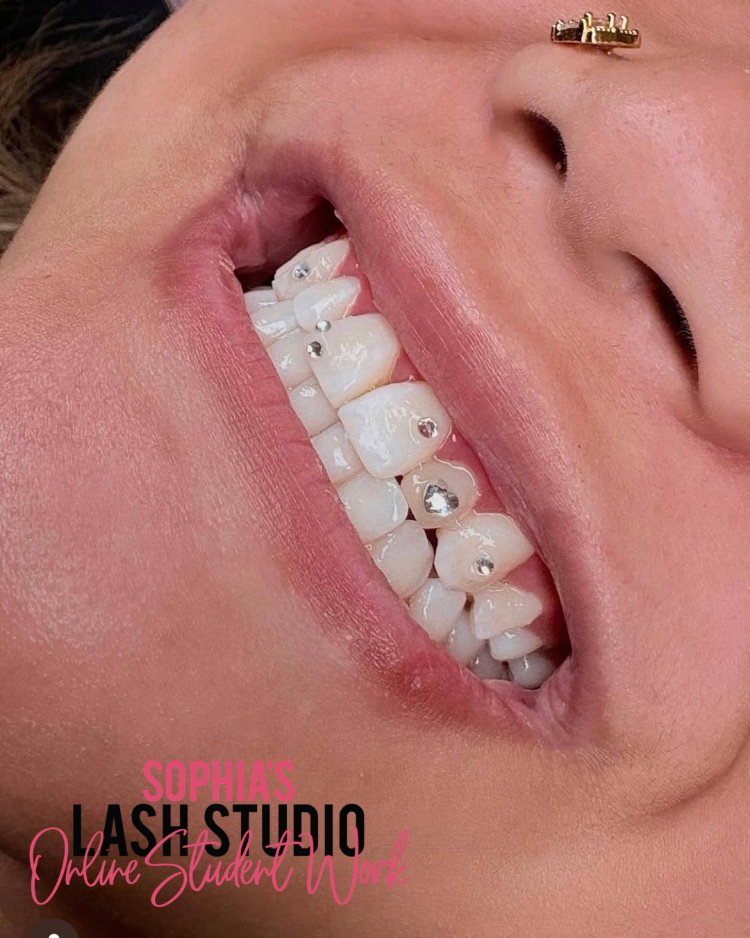Online Tooth Gem Course